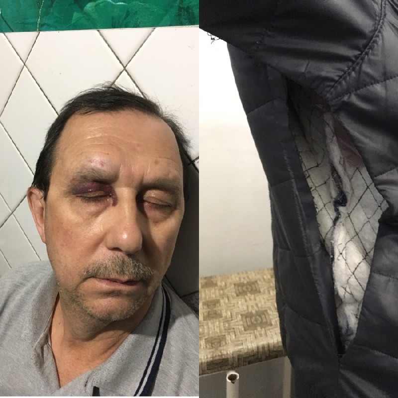 Поступая по совести, Олег получил травмы